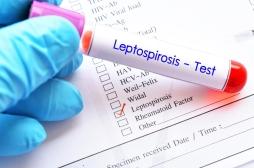 Épidémie de leptospirose à La Réunion : quels sont les risques ?