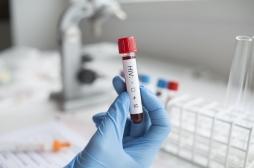 VIH : un cluster identifié en Auvergne-Rhône-Alpes inquiète les autorités sanitaires