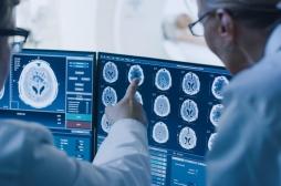 AVC : plus de patients sauvés grâce à cette nouvelle intelligence artificielle