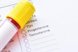 Et si votre taux de testostérone révélait un danger caché ?