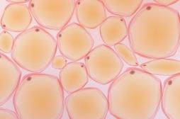 Obésité : cette découverte de scientifiques toulousains renverse 60 années de recherche 