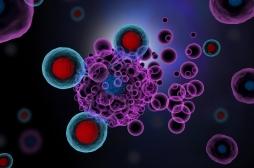 Mélanome : l’immunothérapie améliore la survie