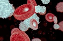 Ses poches sous les yeux cachaient… une leucémie