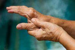 Arthrose de la main : bientôt un nouveau médicament anti-inflammatoire ? 