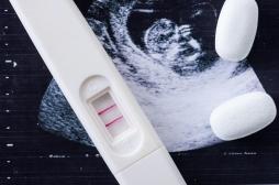 Le Sénat rejette l’allongement des délais d'IVG pendant la crise sanitaire