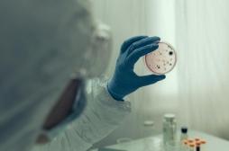 Peste : la bactérie s’est adaptée pour être moins mortelle mais durer plus longtemps