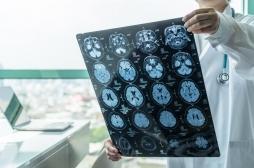 Tumeurs cérébrales : des biopsies 3D pour mieux les étudier