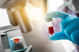 Maladies auto-immunes : un simple test sanguin peut améliorer le diagnostic