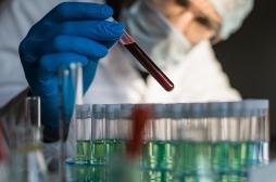 Covid long : une signature sanguine enfin identifiée ?