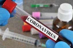 Covid-19 : un nouveau test sérologique plus efficace et précis bientôt disponible