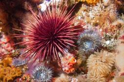 Il se fait amputer parce qu’il a marché sur un oursin !