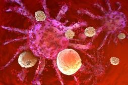 Cancer du col de l’utérus : l’immunothérapie prolonge la survie des patientes