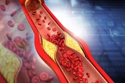 Cholestérol : un traitement à base de plantes à l’étude