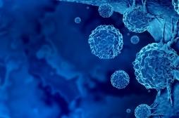 Cancers précoces : le vieillissement accéléré des jeunes générations en cause ?
