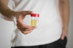 Analyse d’urines : un boîtier connecté pour remplacer les prélèvements en laboratoire