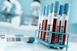 Cancer : choisir le bon traitement grâce à un test sanguin