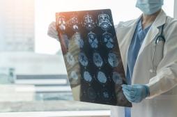 Alzheimer : et si un ordinateur pouvait diagnostiquer la maladie ?