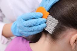 Poux : quels sont les traitements efficaces ? 