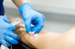 Cancer du poumon : à quel moment de la journée l'immunothérapie doit-elle être administrée ?