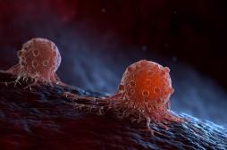 Cellules cancéreuses : des chercheurs identifient un “interrupteur” pour activer leur mort