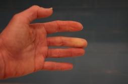 Vous avez les mains froides ? Ce test d'une minute vous dira si vous souffrez du syndrome de Raynaud