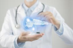 Cancer du pancréas : on pourrait le dépister plus tôt grâce à nos selles