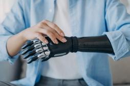 Après une amputation, le corps n'oublie pas le membre perdu