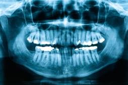 L'apnée du sommeil serait liée à des os et des dents plus faibles chez l’adulte