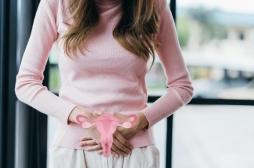 Cancer de l’ovaire : plus de risque chez les femmes ménopausées atteintes du SOPK 
