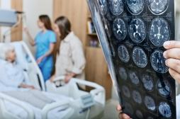 Démence : 5 fois plus de risques après un AVC grave