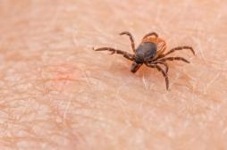 Maladie de Lyme : l’IA pose le diagnostic d’un Britannique en errance médicale