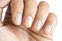 Endocardite : l’état de vos ongles peut alerter sur la maladie
