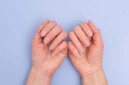 Cancer : cette anomalie bénigne de l'ongle liée à une hausse des risques