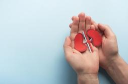Lupus : on sait ce qui peut provoquer des atteintes aux reins 