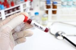 Peste pulmonaire : un premier cas mortel depuis près de 20 ans en Arizona 