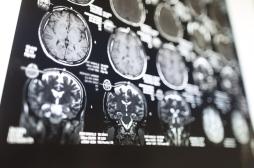 Hyperthymésie : une adolescente possède une mémoire autobiographique hors normes