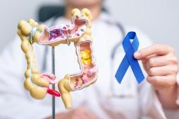 Cancer colorectal : dans quels départements se fait-on le plus dépister ? 