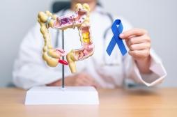Cancer colorectal : quand peut-on être considéré comme guéri ? 