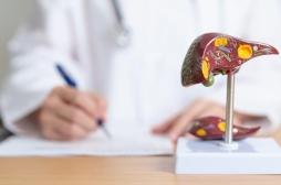 Le dysfonctionnement d’un récepteur cellulaire pourrait expliquer la maladie du foie gras