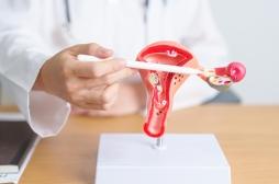 Infertilité, surpoids… Bientôt un vrai traitement contre le SOPK ?