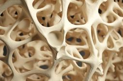 Une simple analyse de sang pourrait aider à évaluer les risques d'ostéoporose