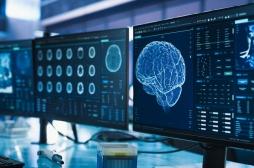 Mort de Nathalie Baye : pourquoi diagnostiquer la démence à corps de Lewy peut-il prendre des années ?