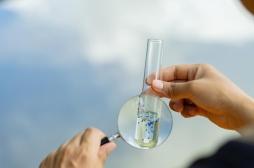 Les microplastiques nuisent à la santé osseuse