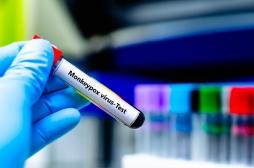 Le mpox n’est plus une urgence de santé internationale