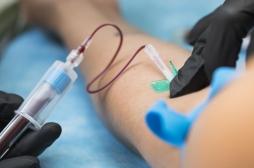 Alzheimer : un test sanguin pourrait prédire la progression de la maladie