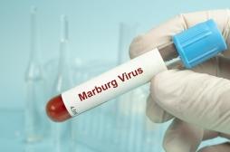 Épidémie en Éthiopie : quels sont les symptômes du virus Marburg ?