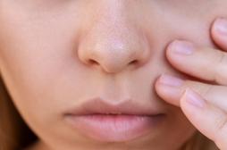 Pourquoi faut-il éviter de percer des boutons dans cette zone du visage ?  