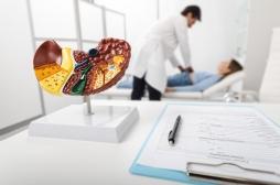 Mort de Thierry Ardisson : pourquoi les cas de cancer du foie pourraient exploser