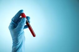 Cancer du poumon : un nouveau test pour identifier les patients à risque