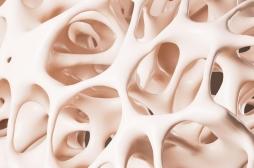 Cancer du sang : l’inflammation de la moelle osseuse pourrait expliquer son apparition 